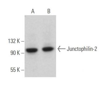 Junctophilin-2 Antibody (B-6) - Western Blotting - Image 374909Each CRISPR/Cas9 Knockout (KO) Plasmid product consists of a pool of 3 plasmids designed to ensure identification and cleavage of a specific gene for maximum knockout efficiency. Each plasmid encodes a unique 20 nt sequence derived from the GeCKO (v2) library.
