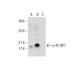 Western blot analysis of 4E-BP1 phosphorylation in untreated (A), calyculin A treated (B) and calyculin A and lambda prote 