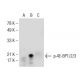 p-4E-BP1/2/3 Antibody (A-10) - Western Blotting - Image 155206