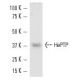 Jurkat + IL-2 Cell Lysate: sc-2278. Western blot analysis of...