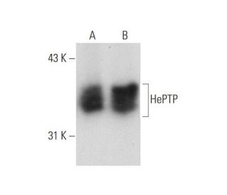 Jurkat + IL-2 Cell Lysate: sc-2278. Western blot analysis of... 