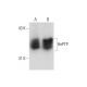 Jurkat + IL-2 Cell Lysate: sc-2278. Western blot analysis of... 