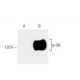 Jurkat + pervanadate Cell Lysate: sc-24716. Western blot analysis of... 