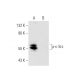 Jurkat + pervanadate Cell Lysate: sc-24716. Western blot analysis of...