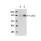 Jurkat + PMA Cell Lysate: sc-24718. Western blot analysis of...