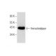 Ferrochelatase Antibody (A-3) - Western Blotting - Image 284415 