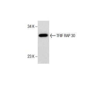 TFIIF RAP 30 Antibody (Y-21) - Western Blotting - Image 285987 
