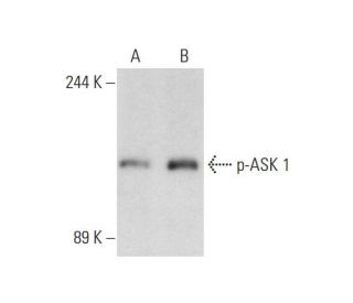 K-562 + TNF alpha Cell Lysate: sc-24723. Western blot analysis of...