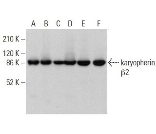 karyopherin β2 Antibody (L5E3) - Western Blotting - Image 382253