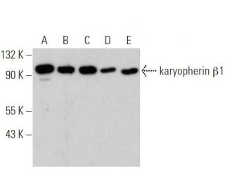 karyopherin &beta;1 Antibody (E-7) - Western Blotting - Image 356162 