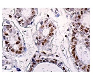 KAT I Antibody (C-7) - Immunohistochemistry - Image 159189 
