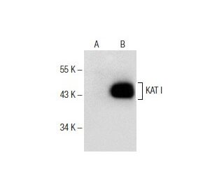 KAT I Antibody (H-11) - Western Blotting - Image 151649