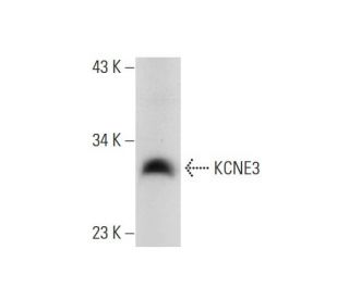 KCNE3 Antibody (G-6) - Western Blotting - Image 299137 