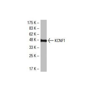 KCNF1 Antibody (56-I) - Western Blotting - Image 33531