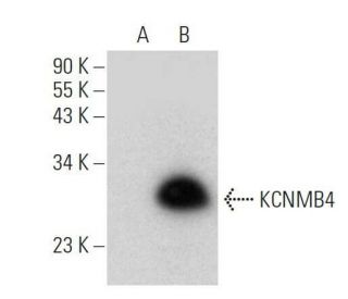 KCNMB4 Antibody (B-6) - Western Blotting - Image 358689