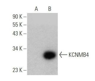 KCNMB4 Antibody (E-5) - Western Blotting - Image 358690
