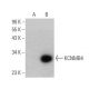 KCNMB4 Antibody (E-5) - Western Blotting - Image 358690