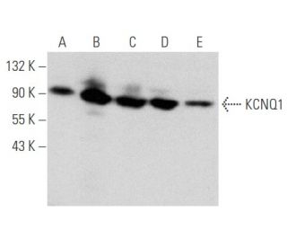 KCNQ1 Antibody (E-7) - Western Blotting - Image 356561 