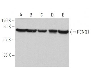 KCNQ1 Antibody (G-8) - Western Blotting - Image 359655 