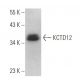 KCTD12 Antibody (F-6) - Western Blotting - Image 371144 