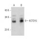 KCTD15 Antibody (AT4C3) - Western Blotting - Image 385148