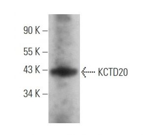 KCTD20 Antibody (B-11) - Western Blotting - Image 369860 