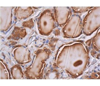 Keap1 Antibody (F-10) - Immunohistochemistry - Image 353021 