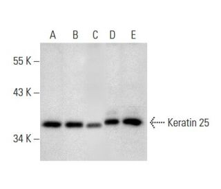 Keratin 25 Antibody (B-2) - Western Blotting - Image 303769 