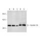 Keratin 25 Antibody (B-2) - Western Blotting - Image 303769 