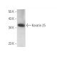 Keratin 25 Antibody (B-2) - Western Blotting - Image 372551