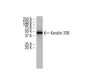 Keratin 33B Antibody (S-28) - Western Blotting - Image 34298 