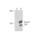 Keratin 33B Antibody (S-28) - Western Blotting - Image 131688