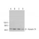 Keratin 74 Antibody (E-6) - Western Blotting - Image 378050