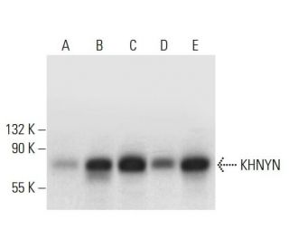 KHNYN Antibody (E-3) - Western Blotting - Image 317965