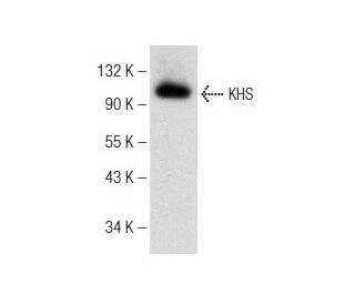 KHS Antibody (D-4) - Western Blotting - Image 148718 