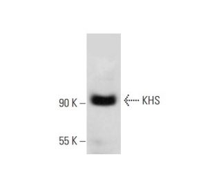 KHS Antibody (E-5) - Western Blotting - Image 318052 