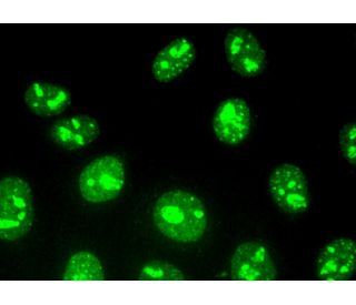 Ki67 Antibody (Ki-67) - Immunofluorescence - Image 370941 