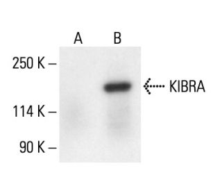 KIBRA Antibody (B-3) - Western Blotting - Image 411258Each CRISPR/Cas9 Knockout (KO) Plasmid product consists of a pool of 3 plasmids designed to ensure identification and cleavage of a specific gene for maximum knockout efficiency. Each plasmid encodes a unique 20 nt sequence derived from the GeCKO (v2) library.