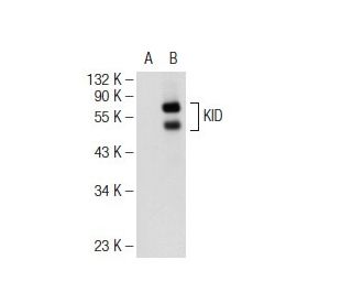 KID Antibody (E-10) - Western Blotting - Image 109116 