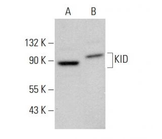 KID Antibody (E-3) - Western Blotting - Image 378770 