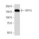 KIF15 Antibody (36-I) - Western Blotting - Image 34318