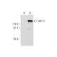 KIF17 Antibody (B-2) - Western Blotting - Image 293081
