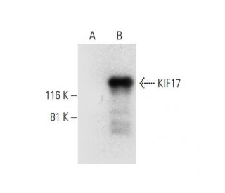 KIF17 Antibody (F-4) - Western Blotting - Image 295792