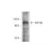 KIF18A Antibody (B-11) - Western Blotting - Image 304947