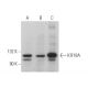 KIF18A Antibody (B-11) - Western Blotting - Image 373994 
