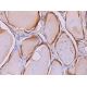 KIF1B Antibody (E-12) - Immunohistochemistry - Image 373634 