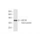 KIF21B Antibody (4C12) - Western Blotting - Image 349531