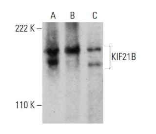 KIF21B Antibody (4C12) - Western Blotting - Image 384446 