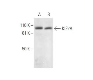 KIF2A Antibody (G-11) - Western Blotting - Image 300153 