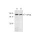 KIF2A Antibody (G-11) - Western Blotting - Image 300153 